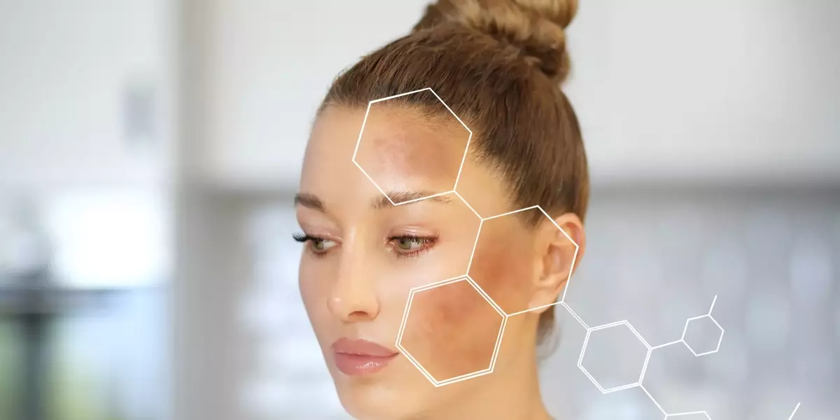 Il Potere degli Antiossidanti: Rivoluzionare i Cosmetici per la Depigmentazione e l'Illuminazione Cutanea