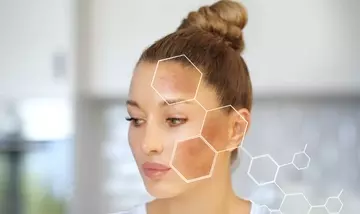 Il Potere degli Antiossidanti: Rivoluzionare i Cosmetici per la Depigmentazione e l'Illuminazione Cutanea